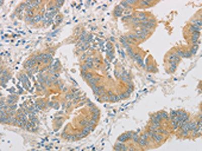 ZWINT Antibody