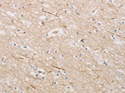 ZWINT Antibody