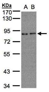 ZYG11BL antibody