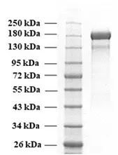 SDS PAGE of SARS-CoV-2 trimeric soluble full-length Spike protein, Delta variant, S protein