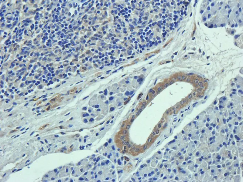 IHC-P image of mouse lymph node tissue using Collagen I antibody (5 ug/ml)