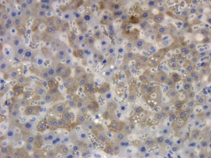 IHC-P staining of rat liver tissue using Collagen X antibody (2.5 ug/ml)