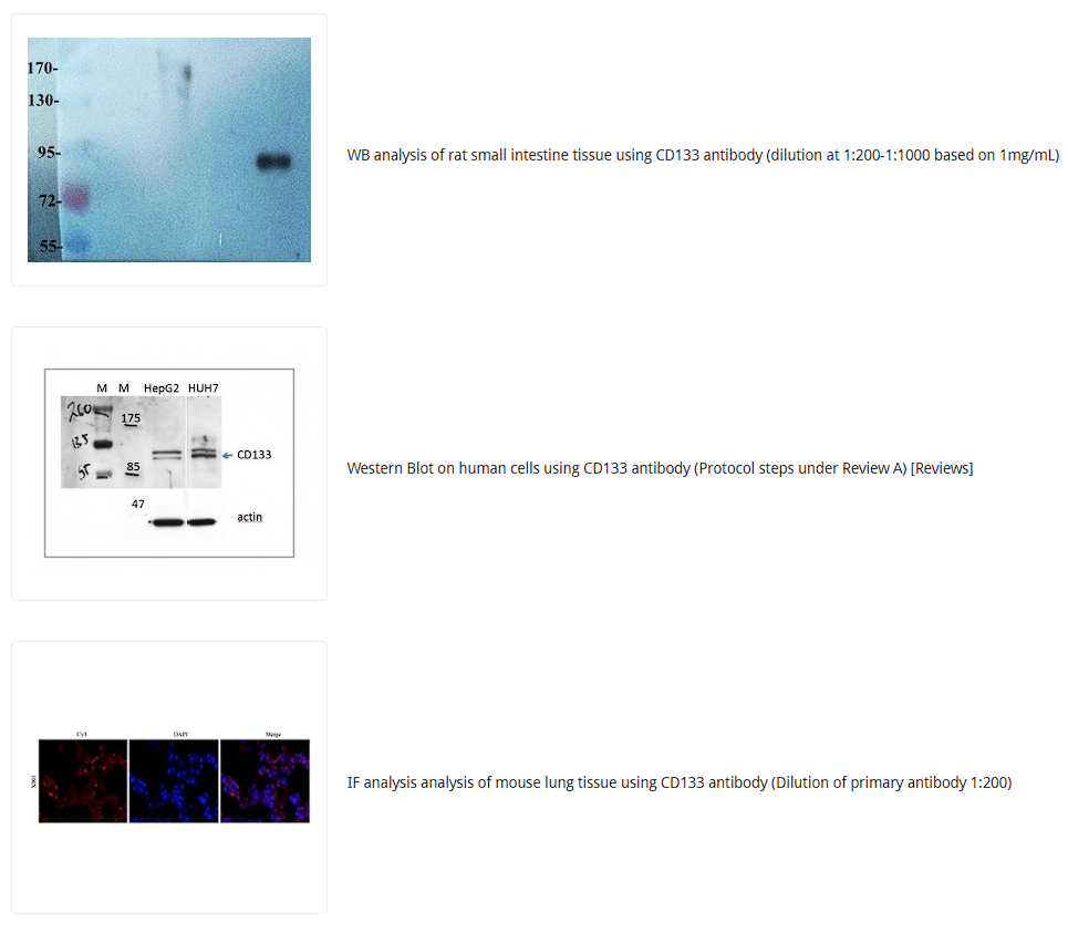 CD133抗体 Biorbyt明星抗体又收录一篇文献，是关于母乳的研究4-2