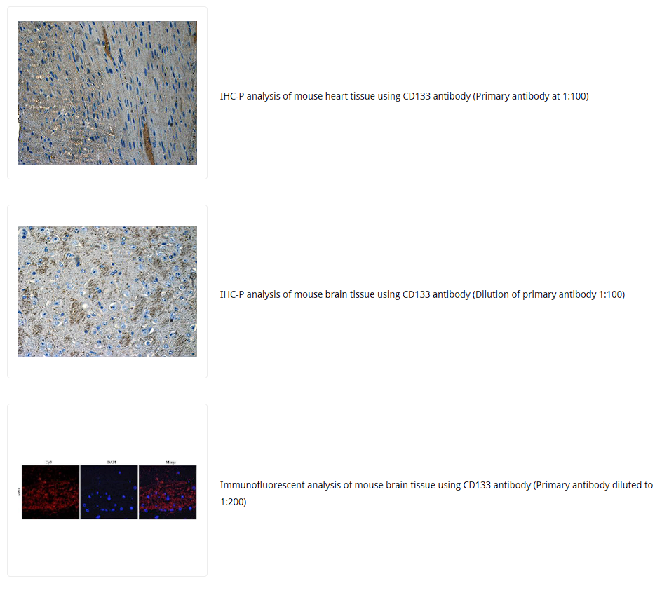 CD133抗体 Biorbyt明星抗体又收录一篇文献，是关于母乳的研究4-4