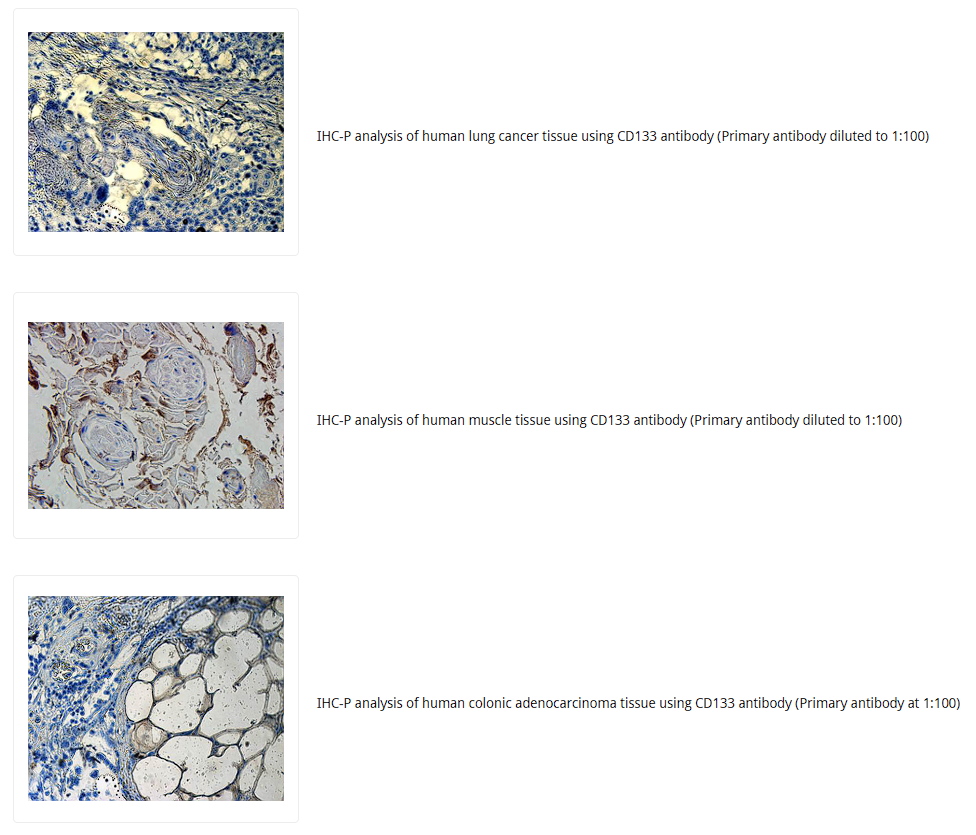 CD133抗体 Biorbyt明星抗体又收录一篇文献，是关于母乳的研究4-7