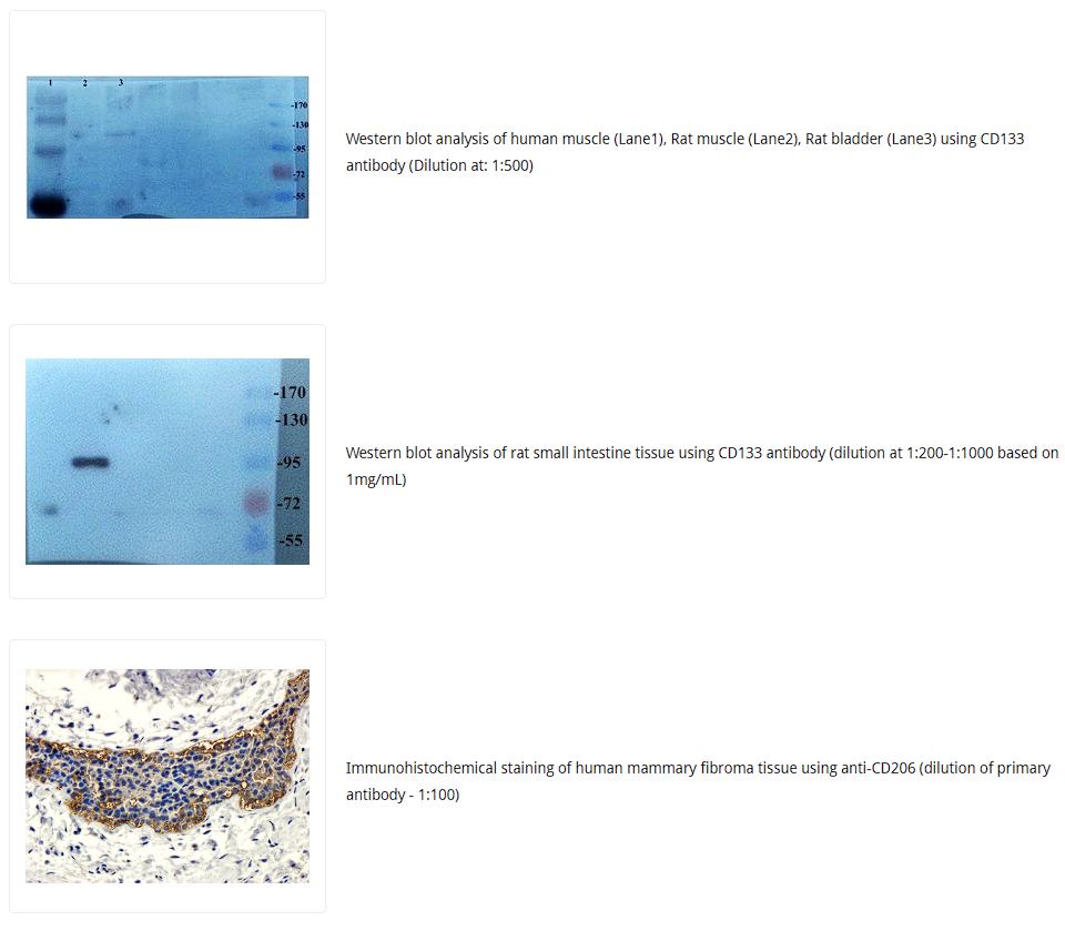 CD133抗体 Biorbyt明星抗体又收录一篇文献，是关于母乳的研究4-8