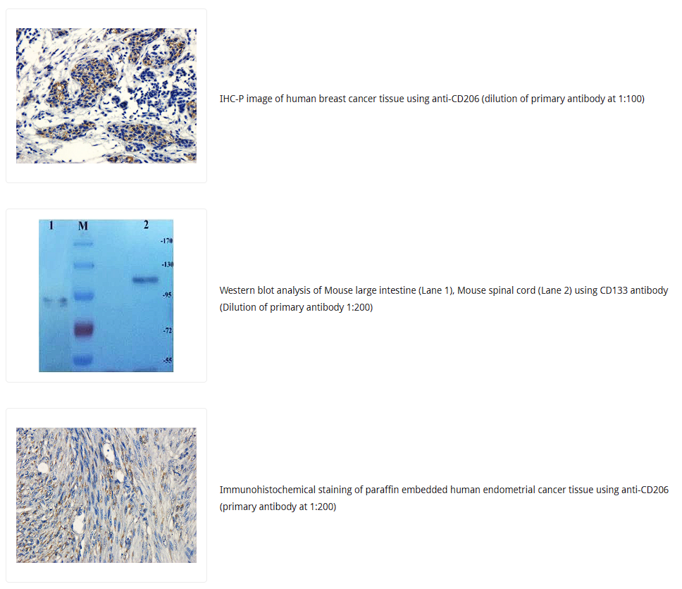 CD133抗体 Biorbyt明星抗体又收录一篇文献，是关于母乳的研究4-9