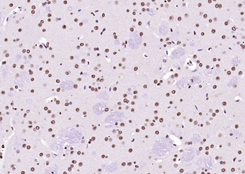 histone-h3-11