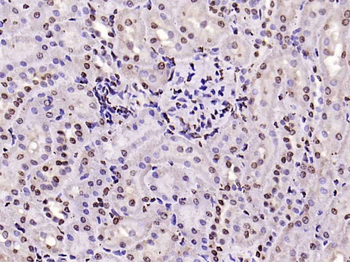 histone-h3-13