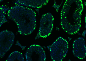 histone-h3-19