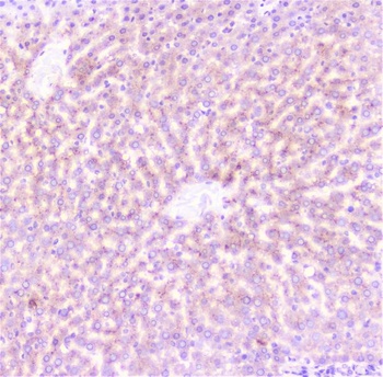 CRP Antibody