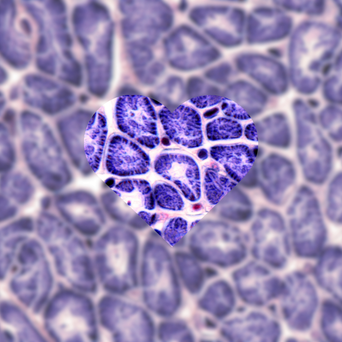 Cardiac Inflammatory Markers