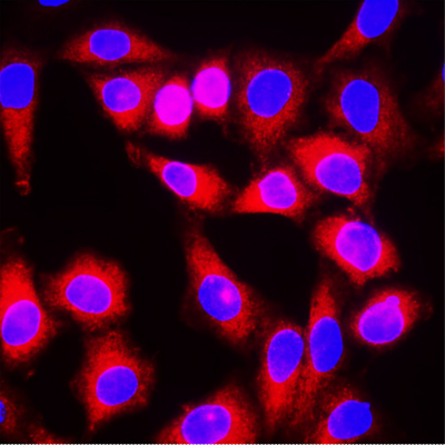 Alpha-smooth muscle actin (α-SMA)