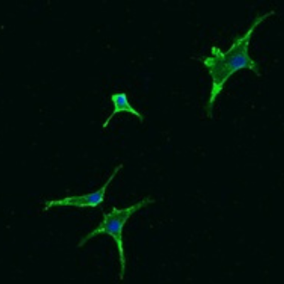 Fibroblast activation protein-alpha (FAP)