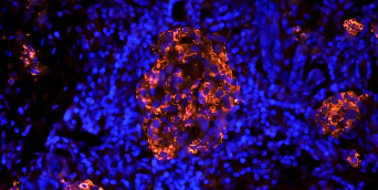 Immunohistochemistry vs Immunocytochemistry