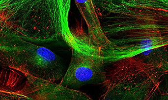 Custom Antibody Conjugation