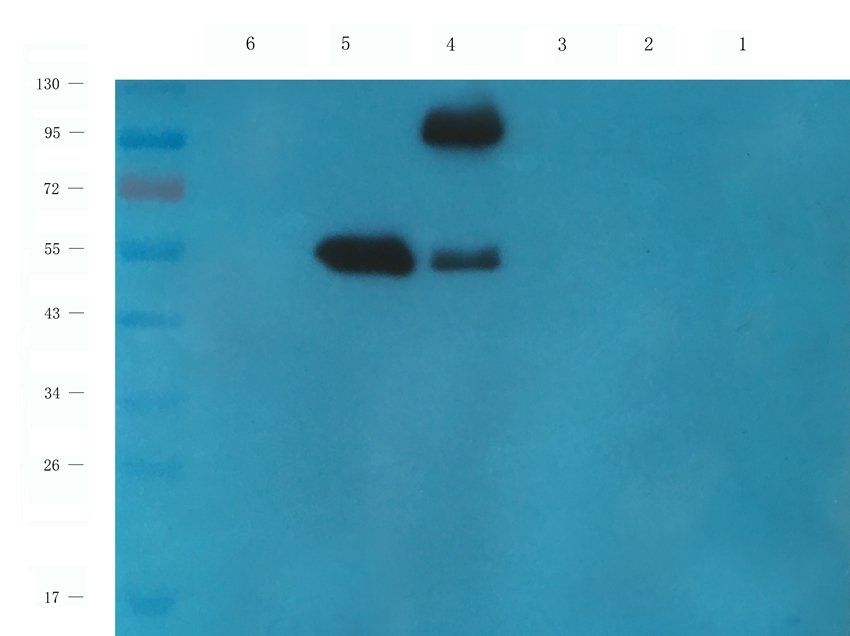 CD213a2 antibody