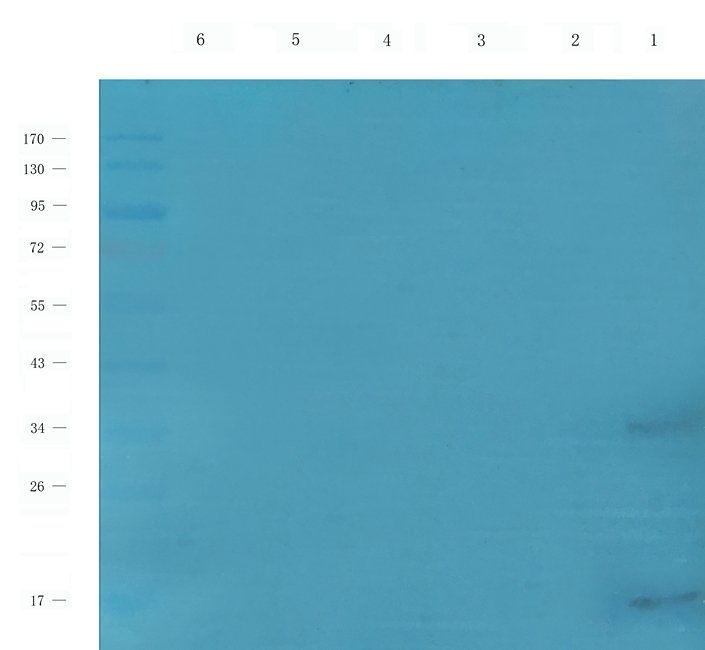 IL26 antibody