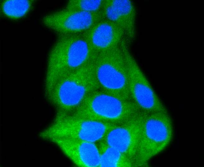 LDL Receptor Antibody