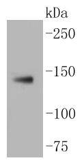 LDL Receptor Antibody