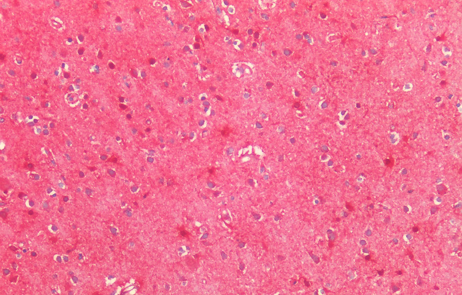 Goat anti-MNSOD (isoform A) Antibody