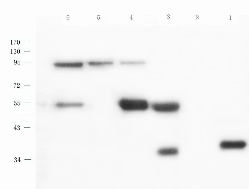 ROR Gamma T antibody