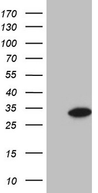 ALOX12 Antibody