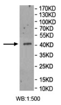 CCDC88C Rabbit Polyclonal Antibody