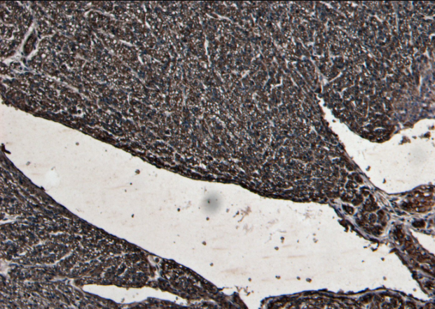 Goat anti-Desmin Antibody