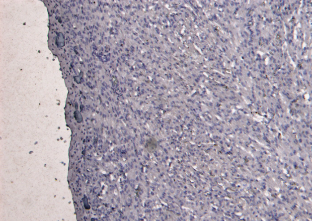 Goat anti-Desmin Antibody