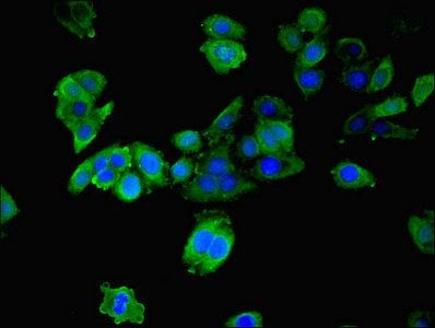 YWHAB Antibody