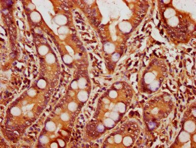 YWHAB Antibody