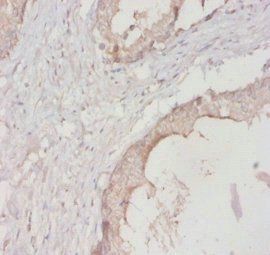 YWHAH Antibody