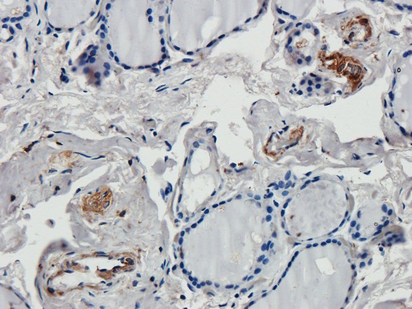 14-3-3 zeta/delta antibody