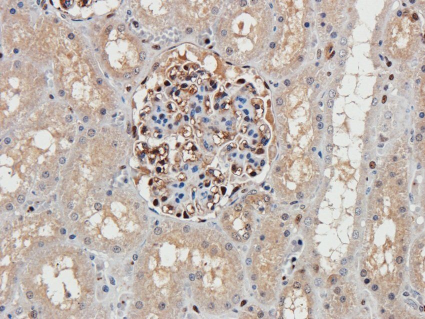 14-3-3 zeta/delta antibody