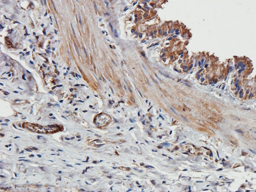 14-3-3 zeta/delta antibody