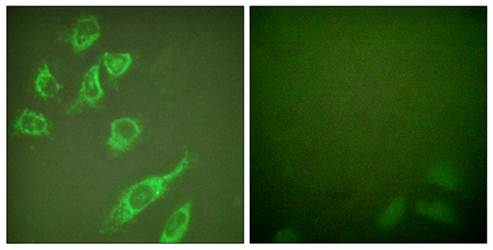 14-3-3 zeta (phospho-Ser58) antibody