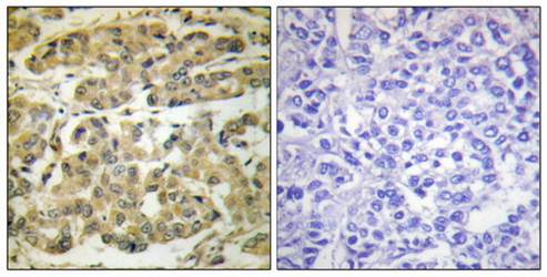 14-3-3 ζ (Phospho-Ser58) Antibody
