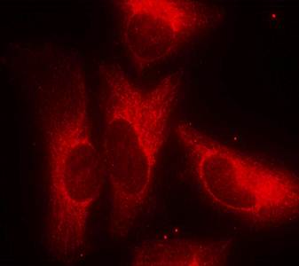 14-3-3 ζ (Phospho-Ser58) Antibody