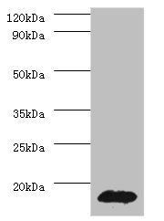 14 kDa phosphohistidine phosphatase antibody