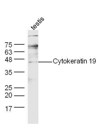 CK19 antibody (FITC)