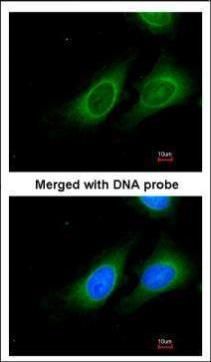 15-PGDH Rabbit Polyclonal Antibody