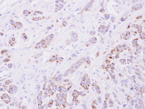 15-PGDH Rabbit Polyclonal Antibody