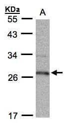 15-PGDH antibody
