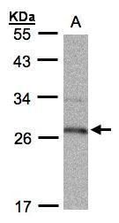 15-PGDH Rabbit Polyclonal Antibody
