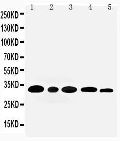 Aquaporin 3/AQP3 Antibody