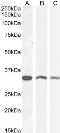 VDAC2 antibody
