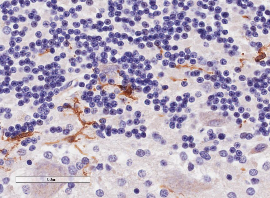 Interferon gamma antibody