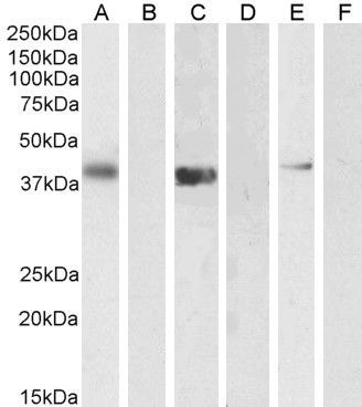 Goat anti-PTF1A / PFT1-P48 Antibody
