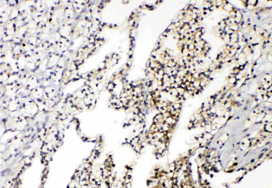 Anti-Aquaporin 3/AQP3 Antibody